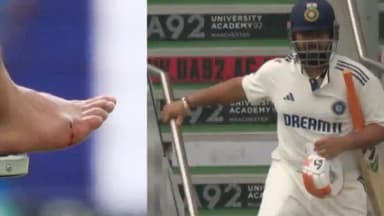 Rishabh Pant injury