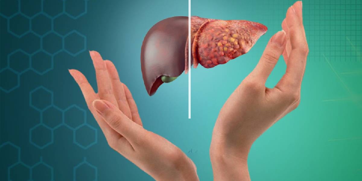 liver protection