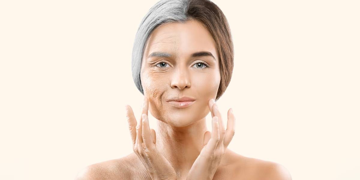 wrinkle