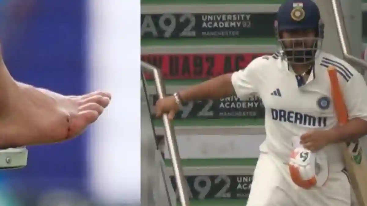 Rishabh Pant injury